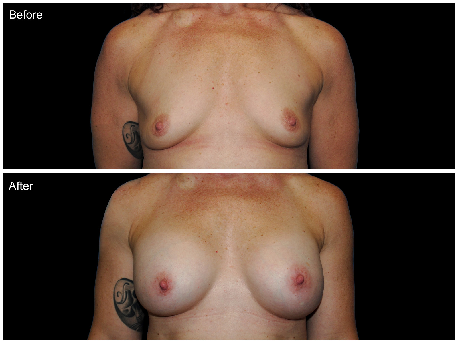 Patient #5108 Image