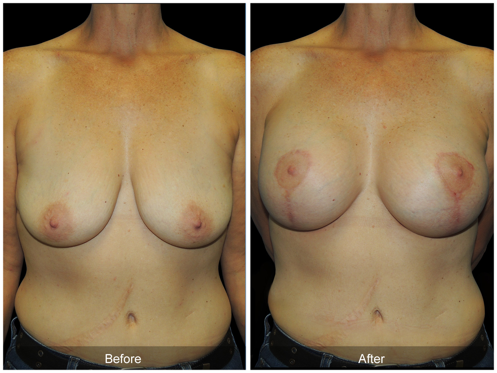 Patient #6842 Image