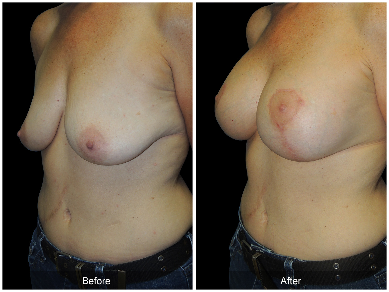 Patient #6842 Image