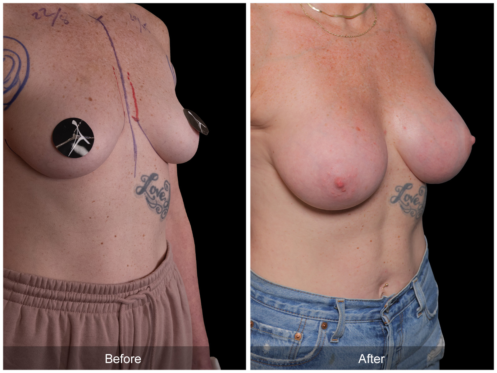 Patient #9471 Image