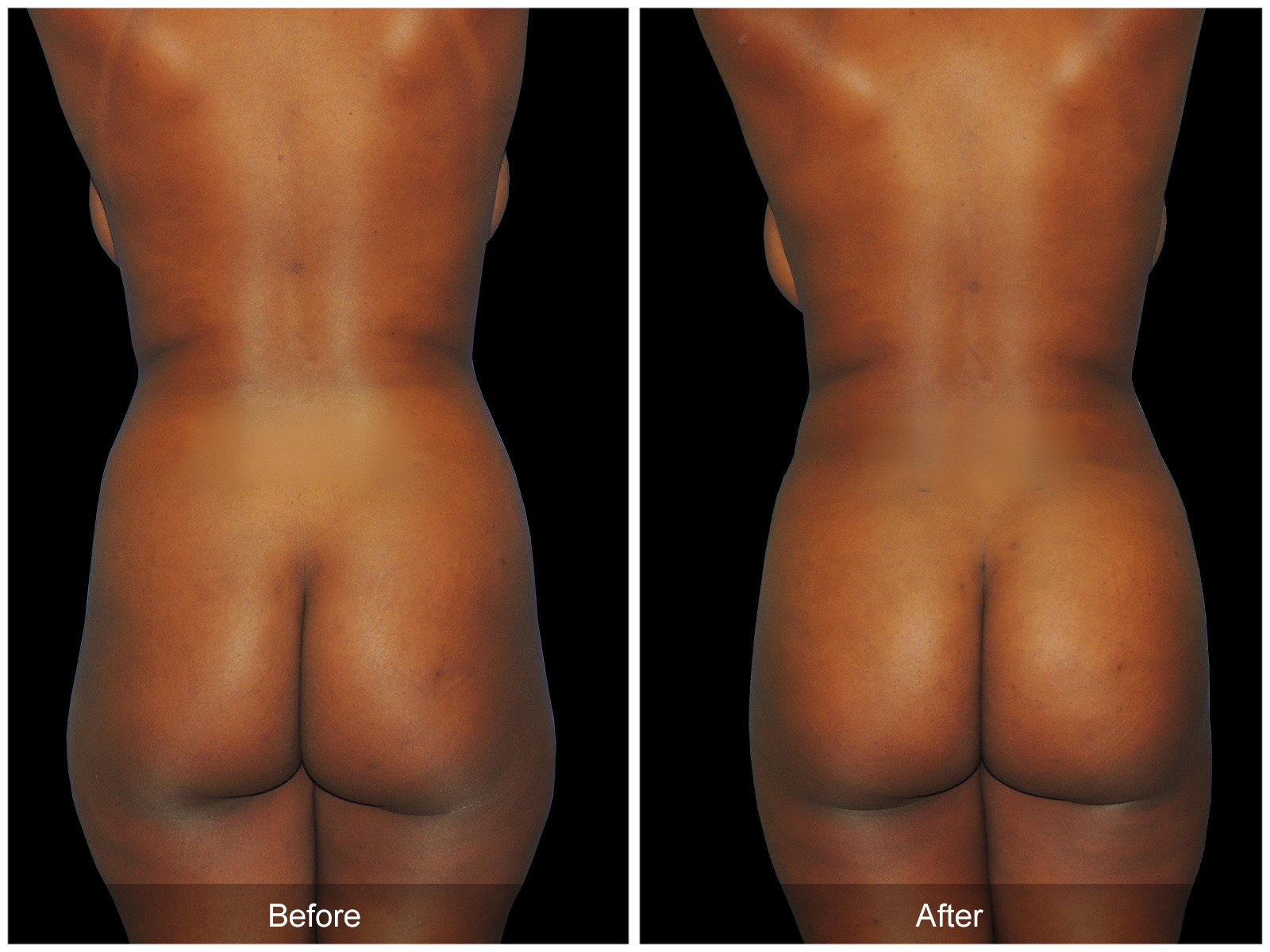 Patient #4682 Image
