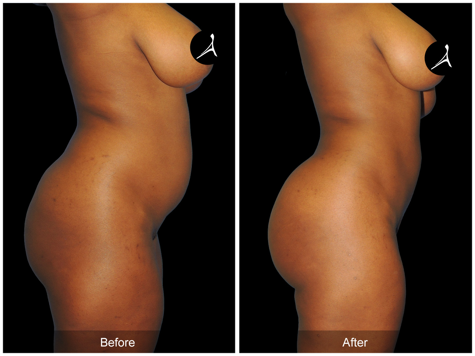 Patient #4682 Image