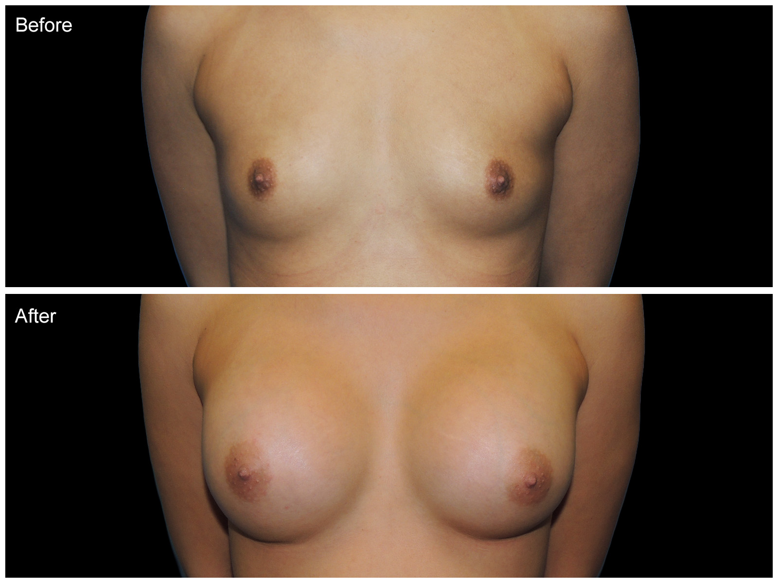 Patient #8620 Image
