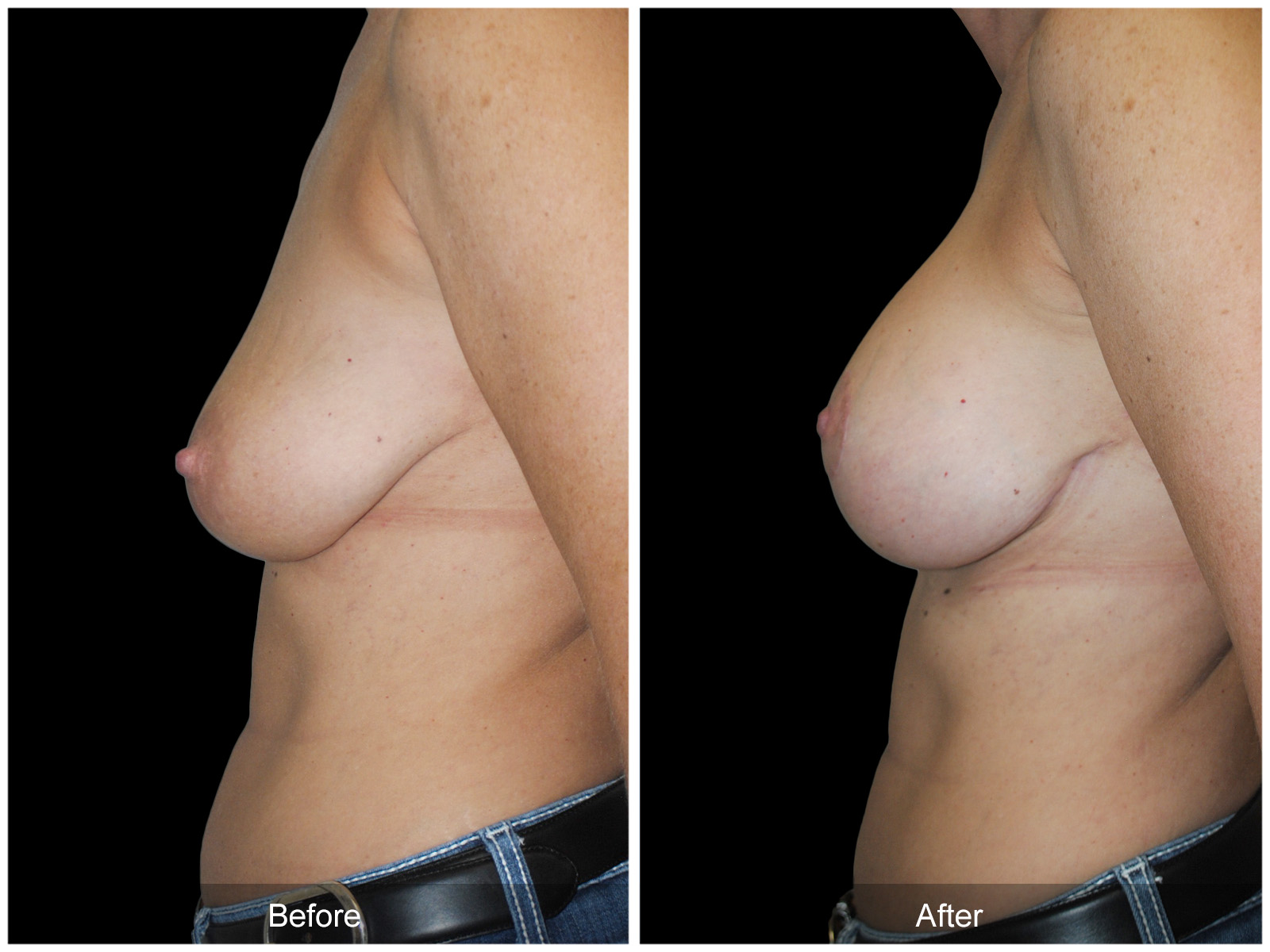 Patient #5368 Image