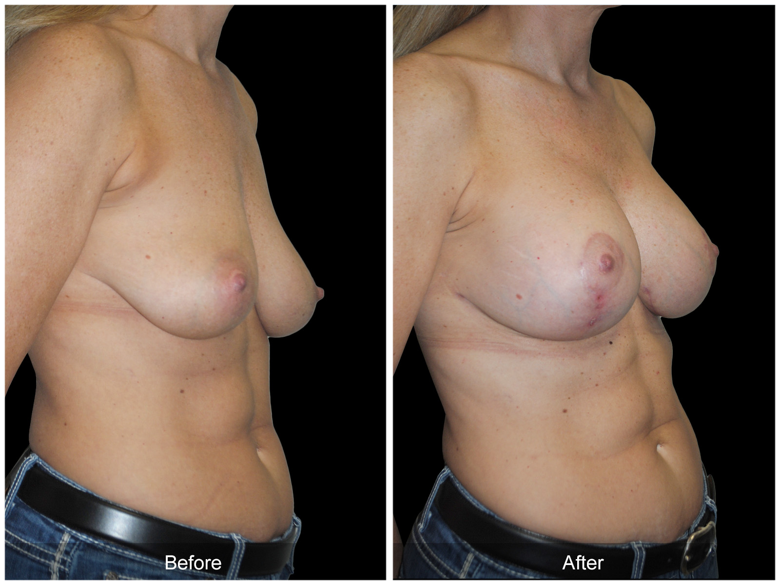 Patient #5368 Image