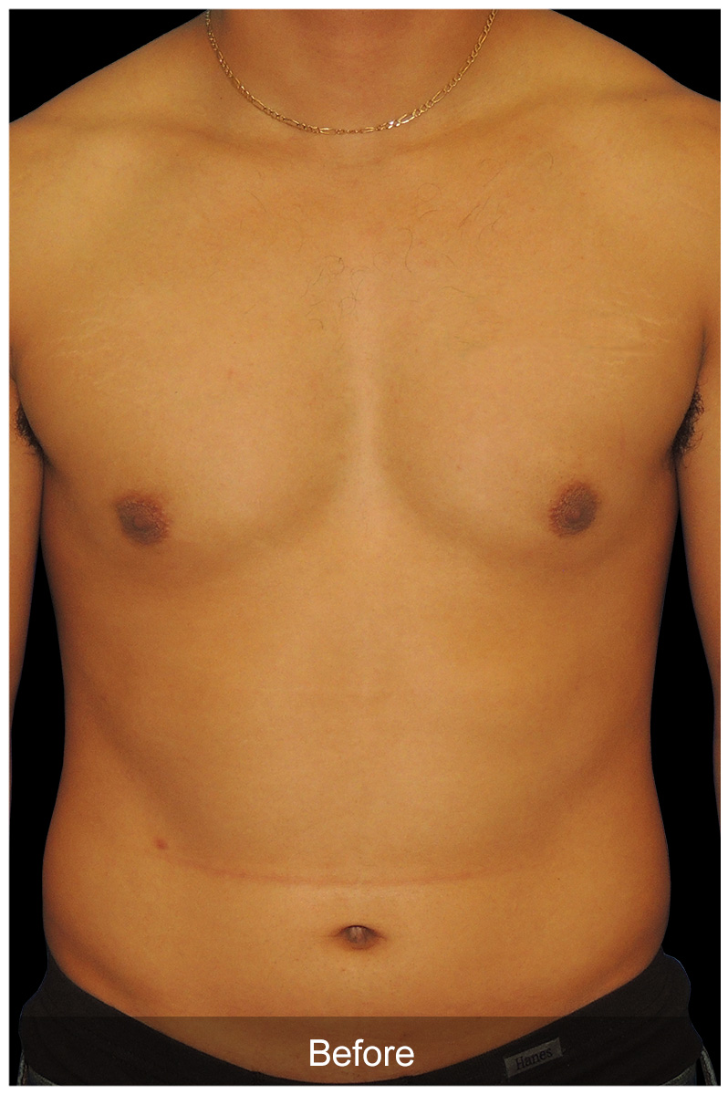 Patient #2869 Image