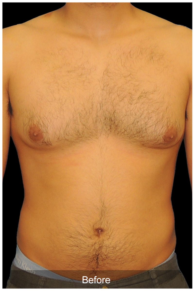 Patient #5029 Image