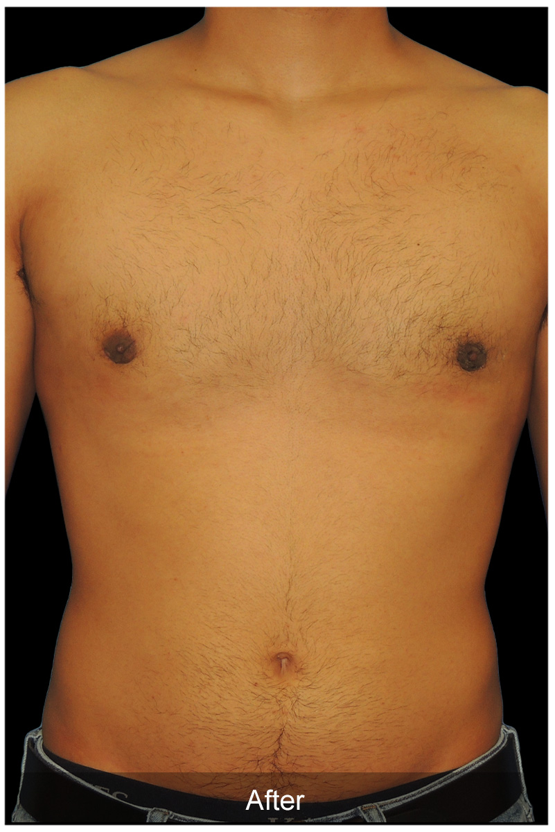 Patient #5029 Image
