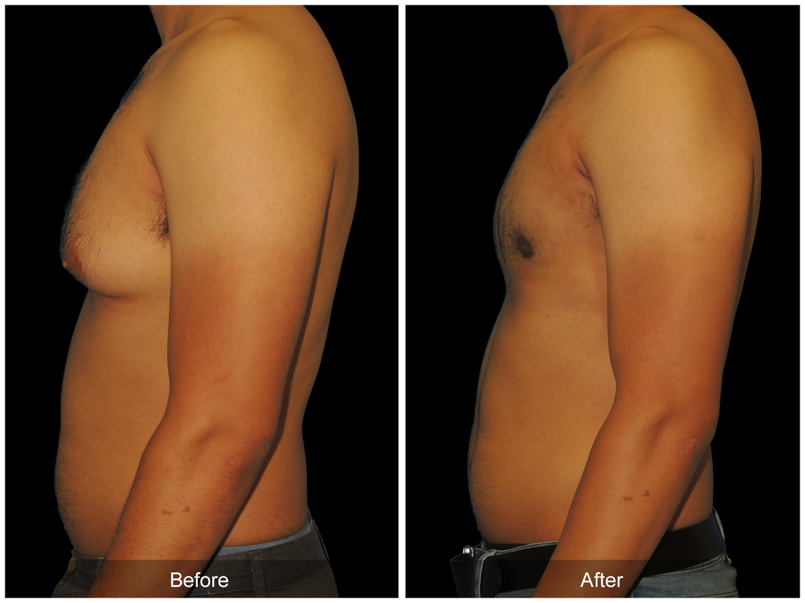 Patient #5029 Image