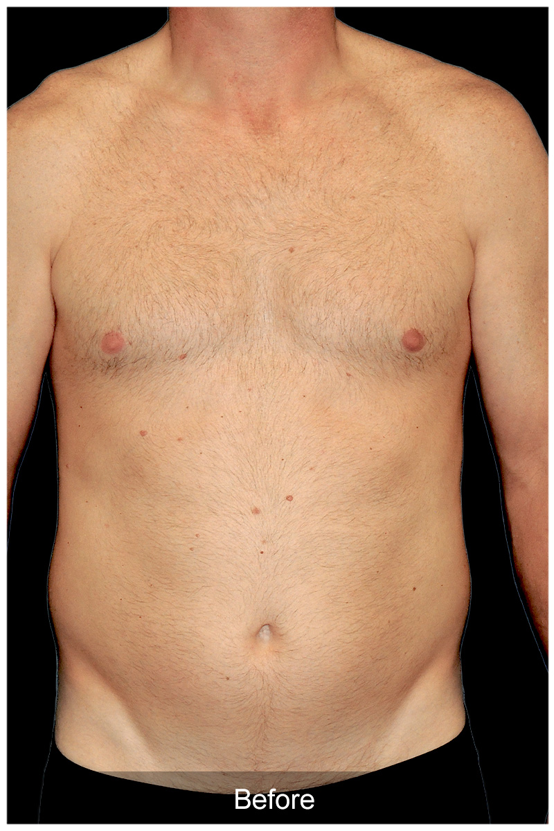 Patient #6134 Image