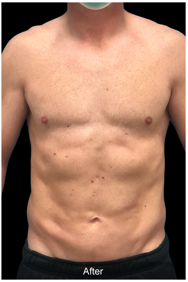 Patient #6134 Image