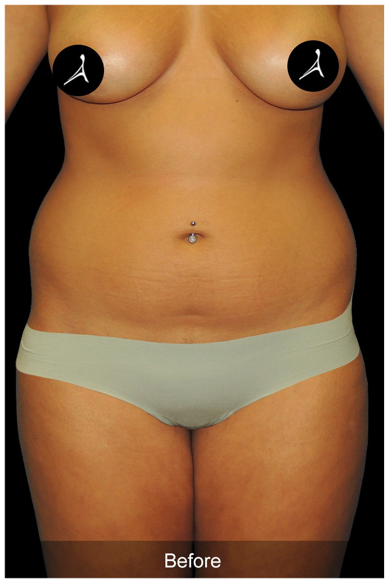 Patient #4185 Image