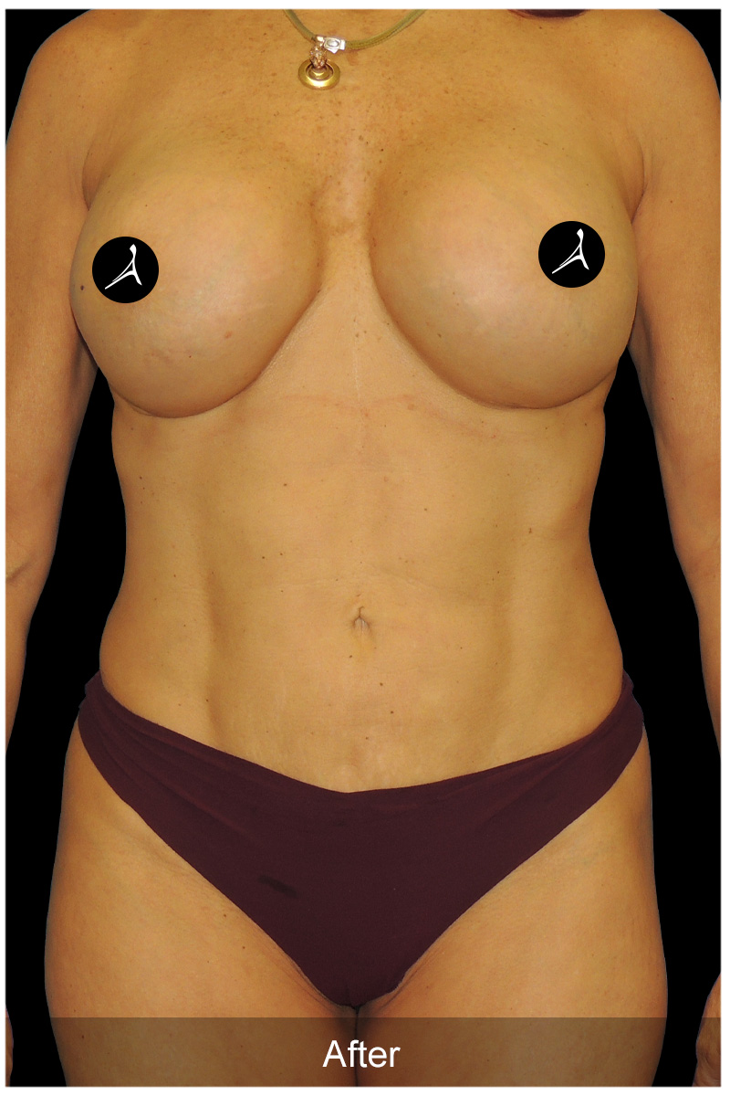 Patient #6091 After Image