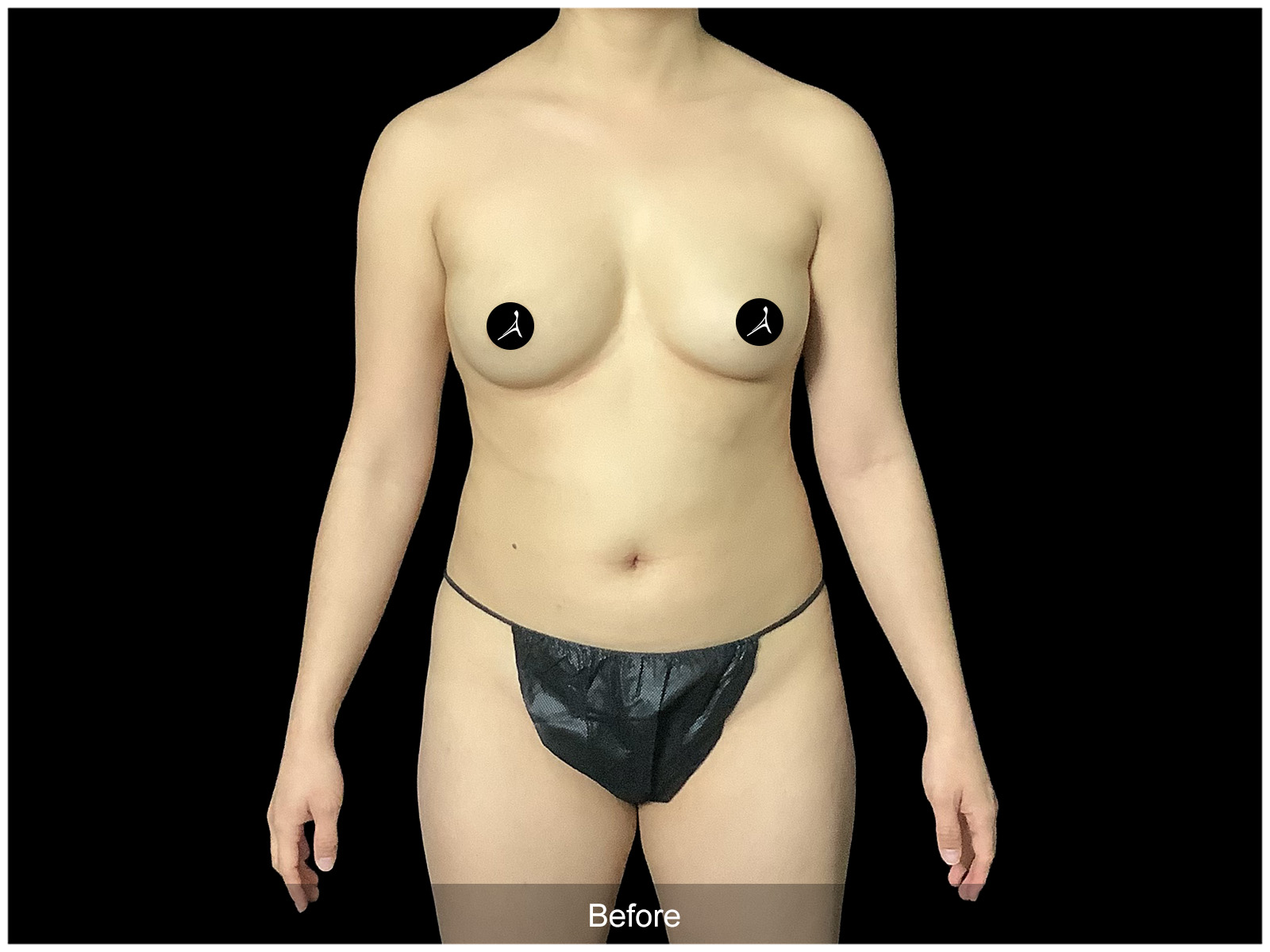 Patient #4793-2 Before Image