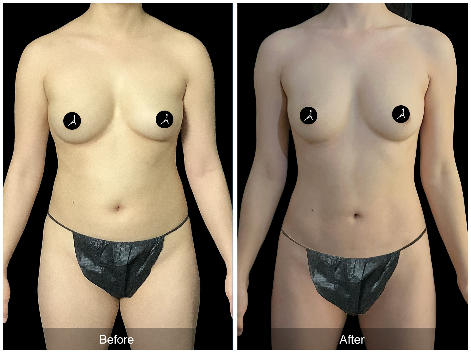 Patient #4793 Image