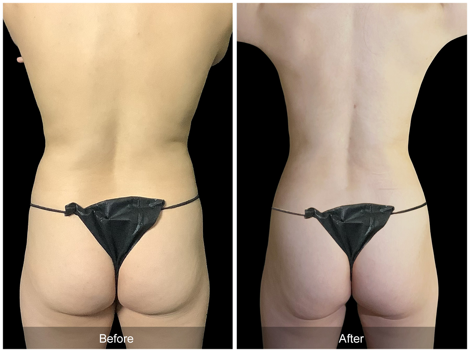 Patient #4793 Image