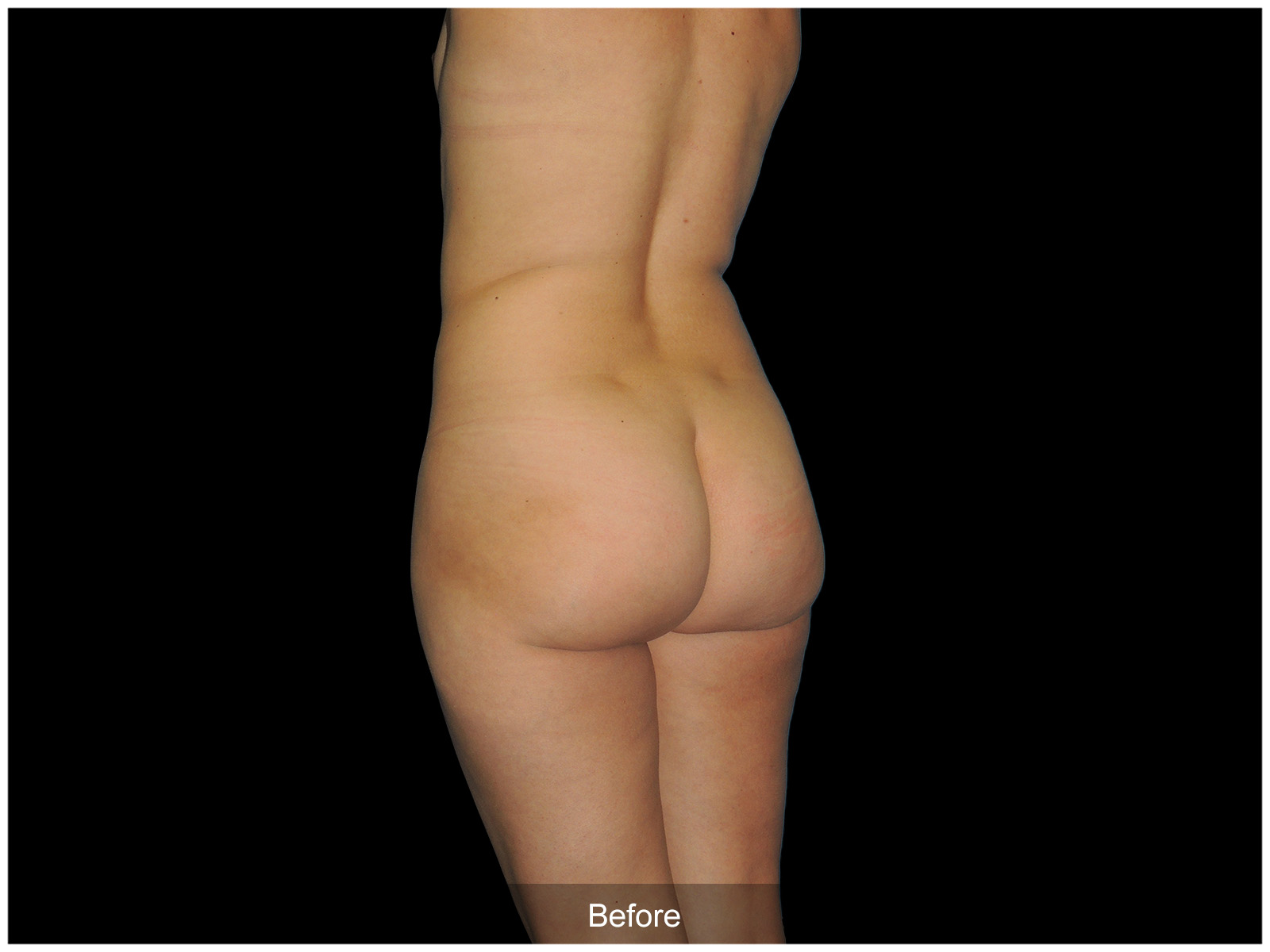 Patient #9132-2 Before Image